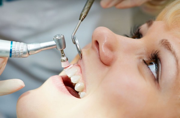 Key Benefits of Teeth Cleaning
