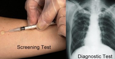 Screening and Diagnostic Tests