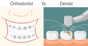 Dentist vs Orthodontist